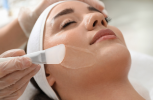 Chemical Peels Houston